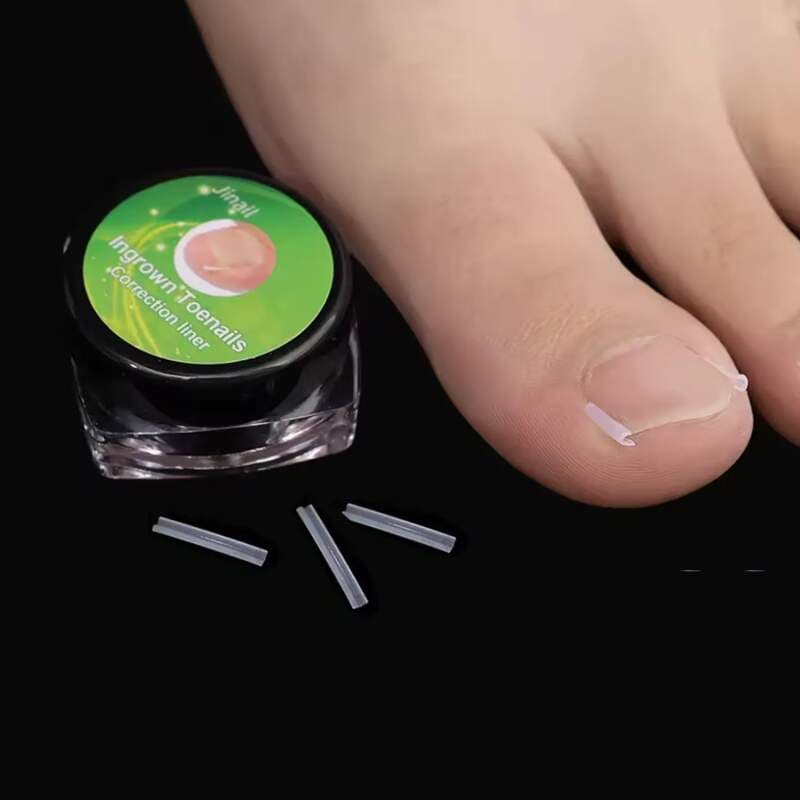 Starnails Podologická sonda Basic - dlátko na nehty, 140mm - náhled 2