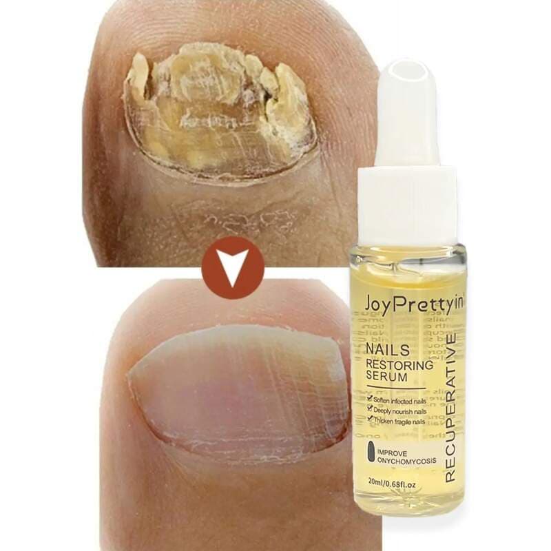 Starnails Sérum proti plísním s obnovou růstu nehtů, 20 ml - náhled 3